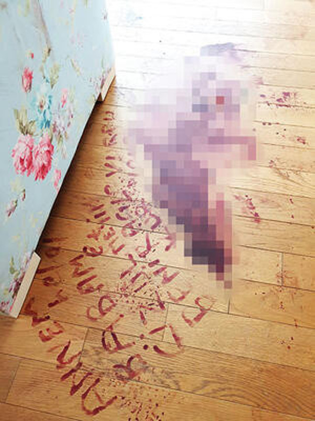 Öleceğini sanıp kendi kanıyla dehşeti yazdı! 'Beni kocam vurdu' - Resim: 2