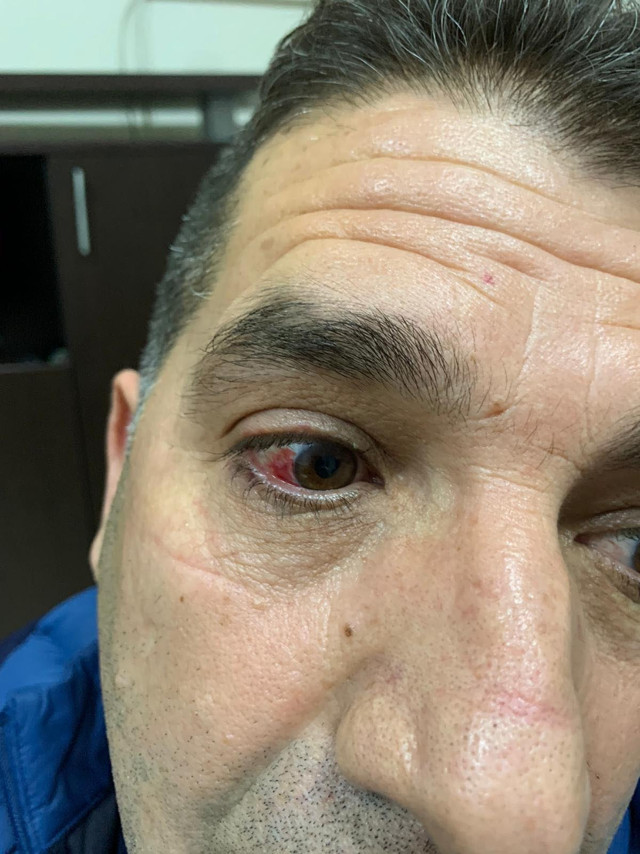 İzmir'de darp edilen Ak Partili Meclis Üyesi'nden olay iddia! Belediye başkanı yaptırdı - Resim: 0