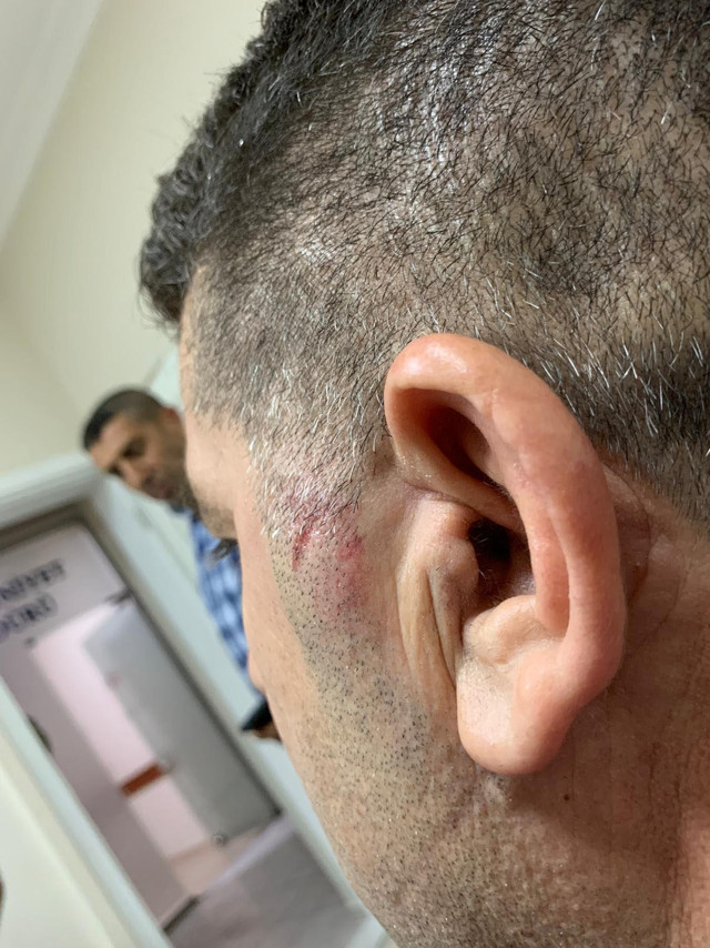 İzmir'de darp edilen Ak Partili Meclis Üyesi'nden olay iddia! Belediye başkanı yaptırdı - Resim: 2