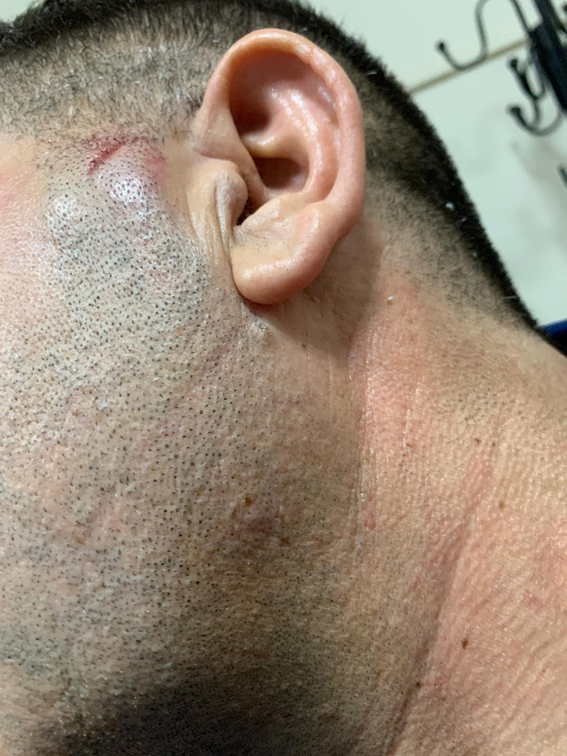 İzmir'de darp edilen Ak Partili Meclis Üyesi'nden olay iddia! Belediye başkanı yaptırdı - Resim: 1