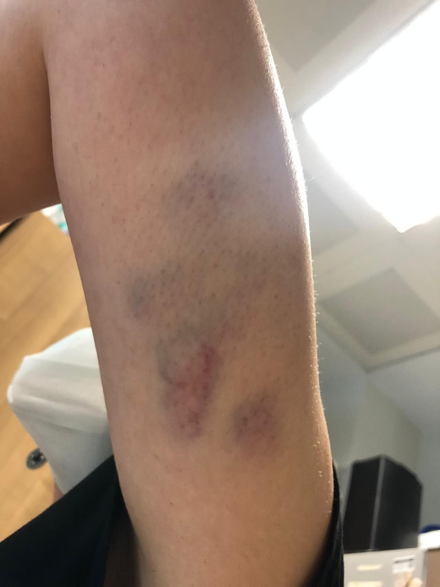 Artvin'de COVİD-19 hastası "Bana bakmak zorundasın" diyerek hekime saldırdı - Resim: 0