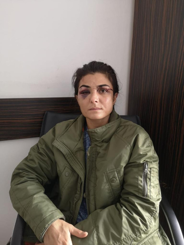 Melek İpek'ten kahreden karar! Tıp yerine hapse girdi - Resim: 2