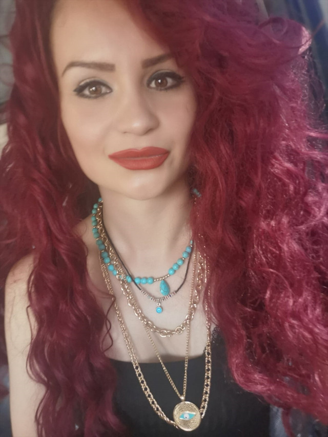 Kocaeli'de leke tedavisinde yüzü yandı - Resim: 1