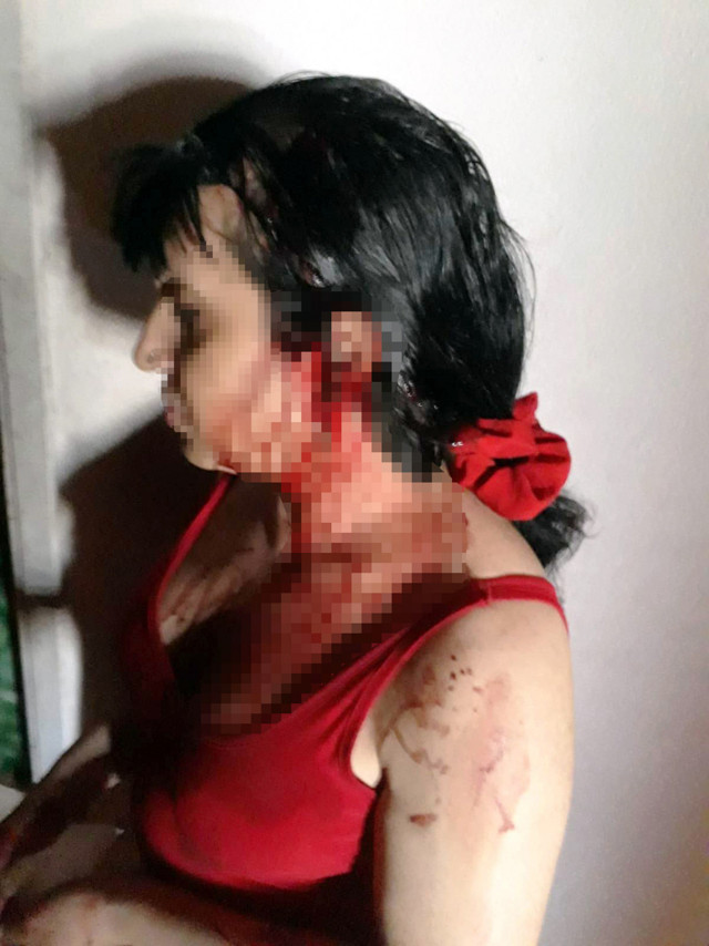 Antalya'da trans bireylerin beyzbol sopalı kavgası! Kanlar içinde hastaneye kaldırıldı - Resim: 0