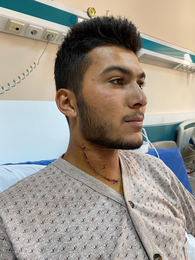 Ankara'da şah damarı kesilen işçi yüzde bir ihtimalle hayata tutundu - Resim: 0