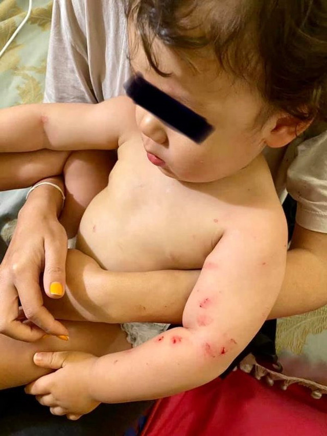 İstanbul'da tarihi otelde Fransız çifte büyük şok! Bomba gibi patladı - Resim: 1