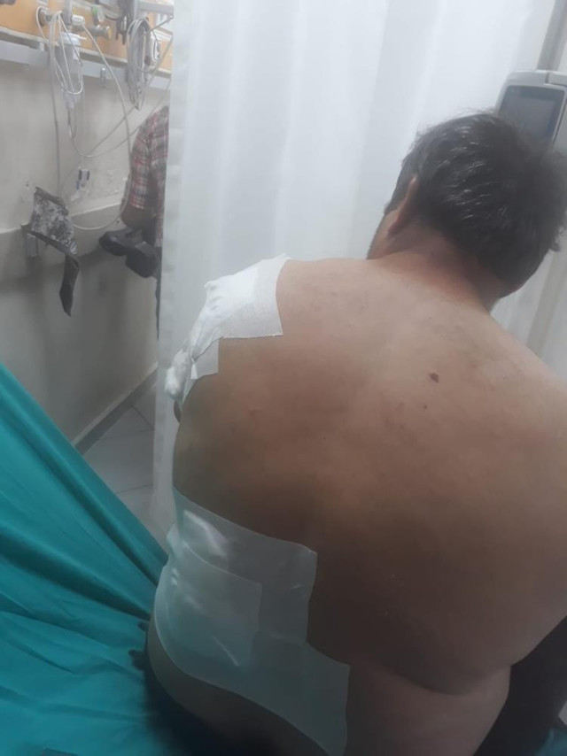 'Ayı böbreğimi söktü dedim, ısırıp ısırıp bıraktı! Bartın'da yaşanan tuhaf olay - Resim: 0