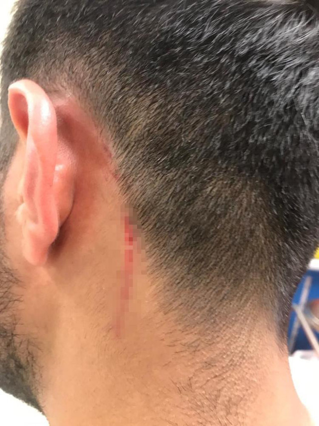 Alçılı kolla ve falçatayla saldırıp, kulağından ısırdı! Galata'da akılalmaz kavga - Resim: 1