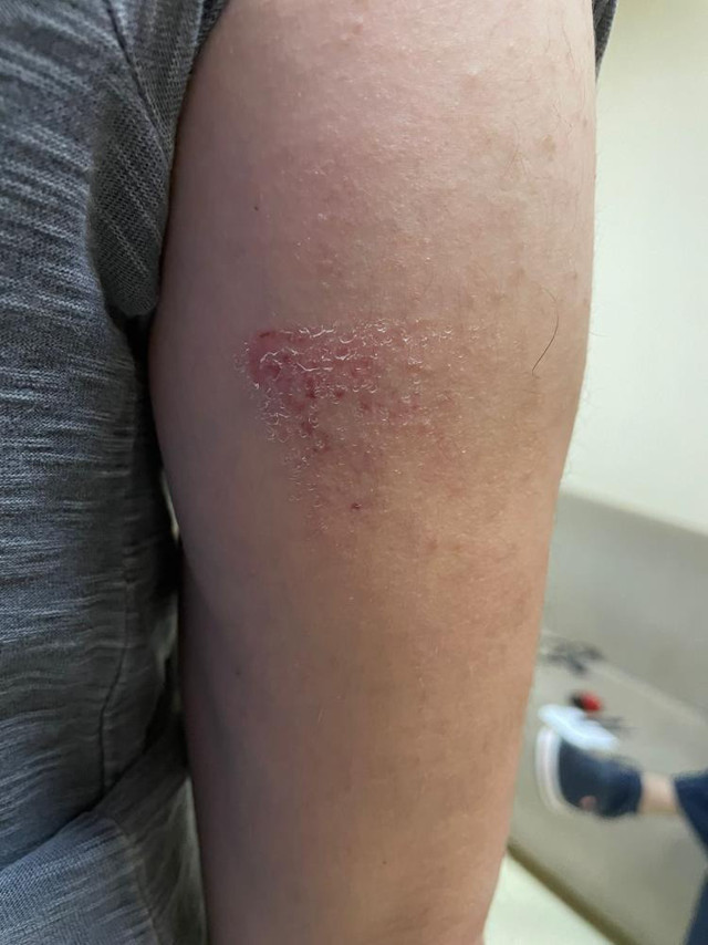 Diyarbakır’da sağlık çalışanlarına sopalı saldırı - Resim: 0