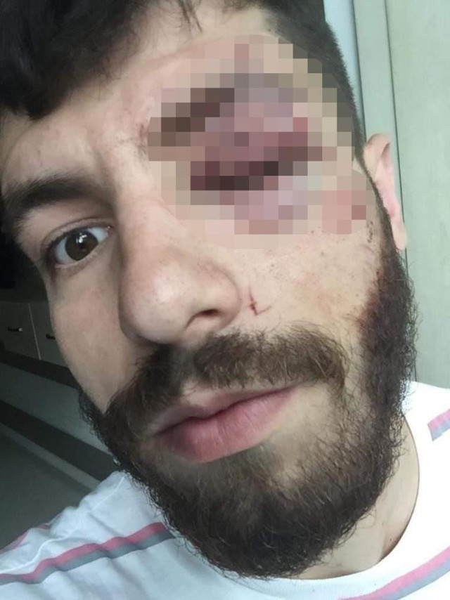 Sigortasız çalıştırılan işçi, sigorta isteyince olanlar oldu! Cam bardak fırlattıp, bu hale getirdiler... - Resim: 3