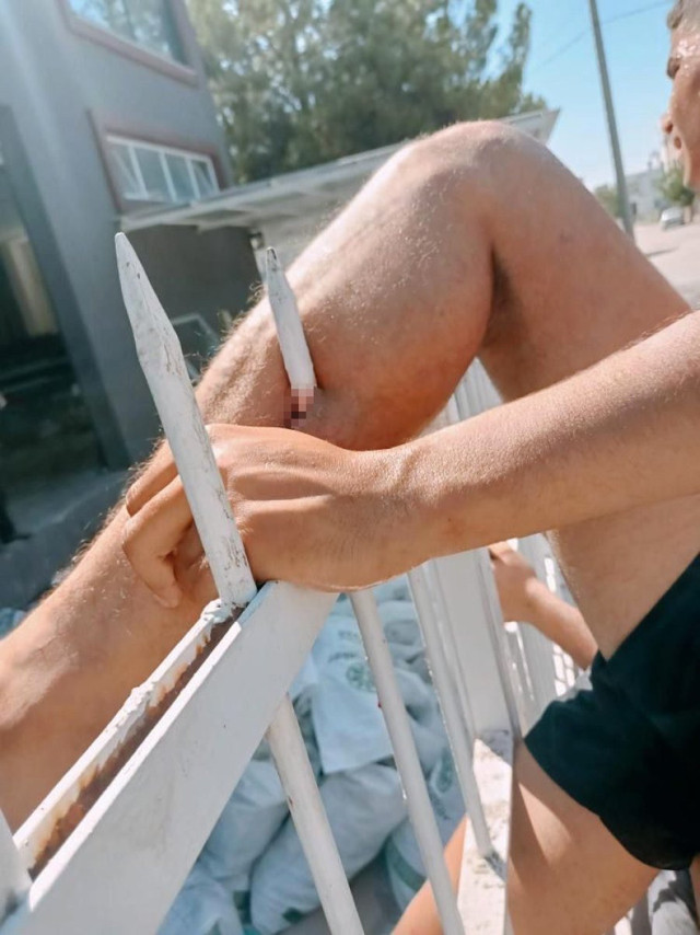 Korkunç olay! Talihsiz gencin bacağına korkuluk demirleri ok gibi saplandı - Resim: 0