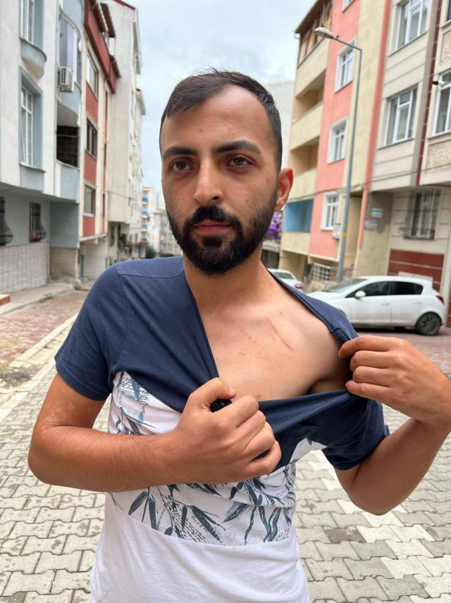 Kız kardeşine verdiği 10 bin TL'yi geri isteyen ambulans şoförü öldüresiye dayak yedi - Resim: 0