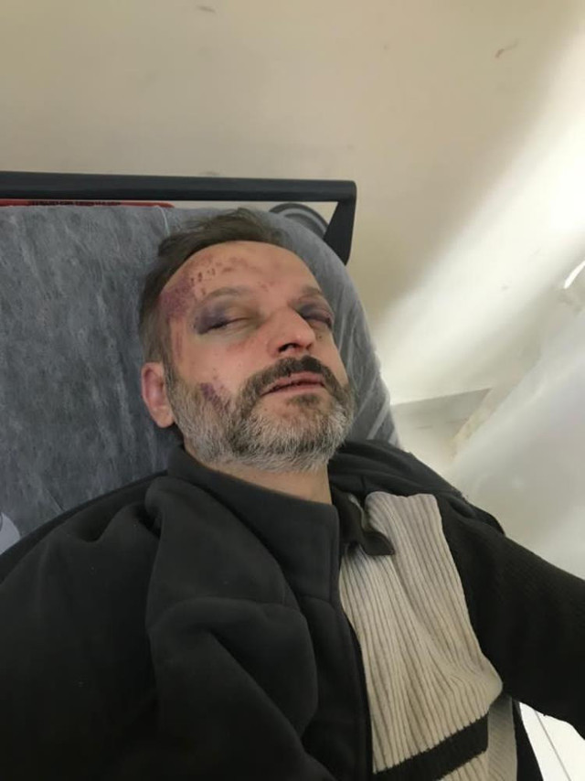 Yeni istek parça vahşeti! Bu nasıl bir vicdansızlık! Aynı parçayı tekrar çalmadı diye öldüresiye dövdüler - Resim: 2