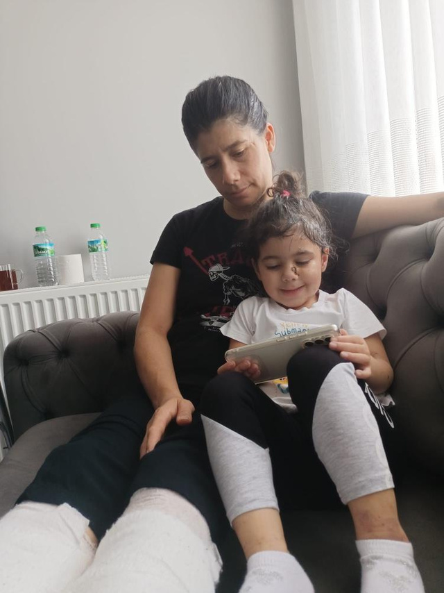 Taksim'deki hain saldırıda 'Bebek arabası' görüntüsü yürek yakmıştı: Yaralı Almeda ve annesinden mesaj var! - Resim: 4