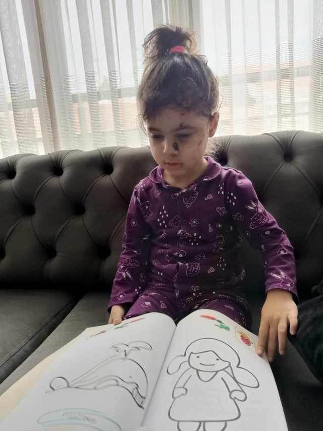 Taksim'deki hain saldırıda 'Bebek arabası' görüntüsü yürek yakmıştı: Yaralı Almeda ve annesinden mesaj var! - Resim: 5