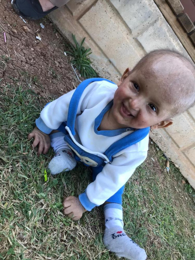 Evde soba yanınca balık kokusu yayan çocuk! Minik Taha'nın eşi benzeri görülmemiş hastalığı - Resim: 5