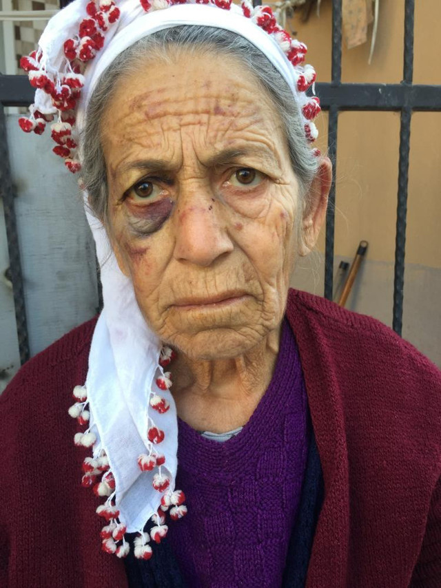 Bayılana kadar dövüldü, altınları çalındı! Kanser hastası kadın dehşet anlarını anlattı: "Kapıyı açar açmaz..." - Resim: 0