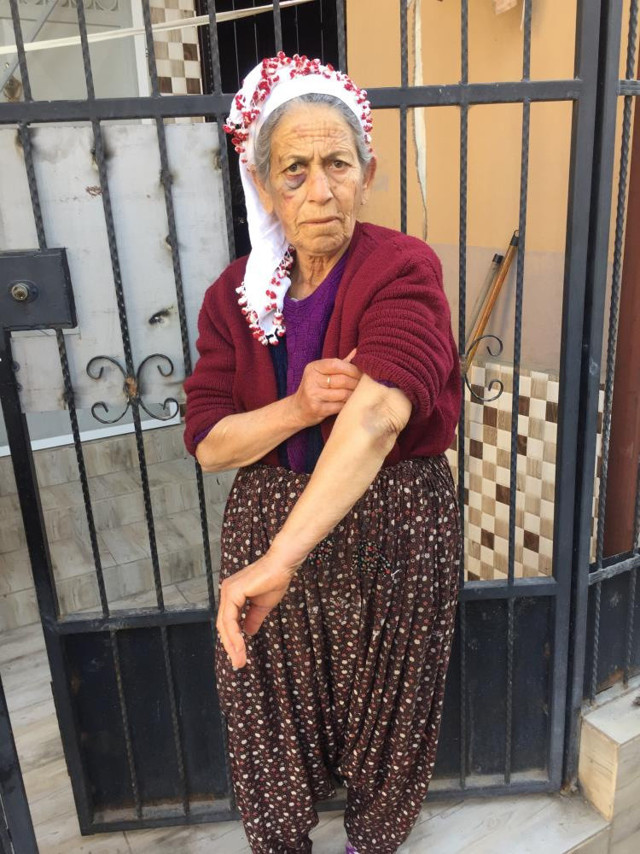Bayılana kadar dövüldü, altınları çalındı! Kanser hastası kadın dehşet anlarını anlattı: "Kapıyı açar açmaz..." - Resim: 5