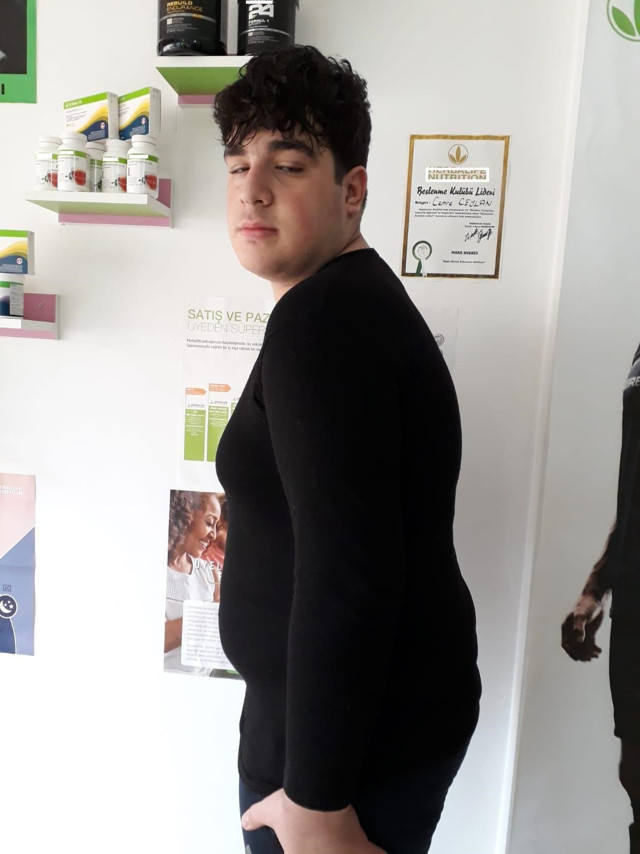 Okulda dalga geçilince eğitimini yarıda bıraktı! Hayatını karartan kilolarından 6 ayda kurtuldu - Resim: 1