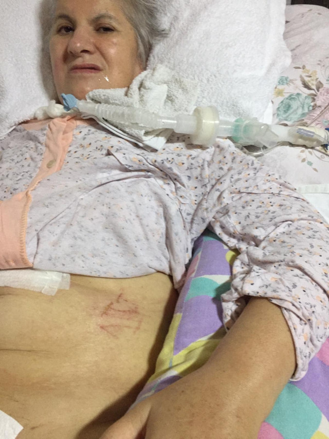 Yanlış yumurtalığı alınan kadına doktordan küstah cevap! "Bikini de giymeyiver" - Resim: 2