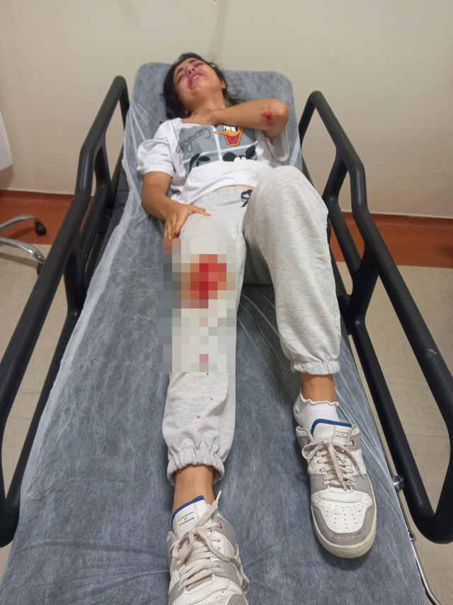 İşe giderken köpekler saldırdı! Ölümden dönen genç kadın o anları gözyaşlarıyla anlattı - Resim: 1