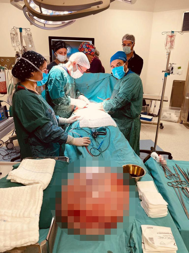 Kocaeli'de hamile olduğunu sanan kadının karnından 15 kilo kist çıktı - Resim: 1