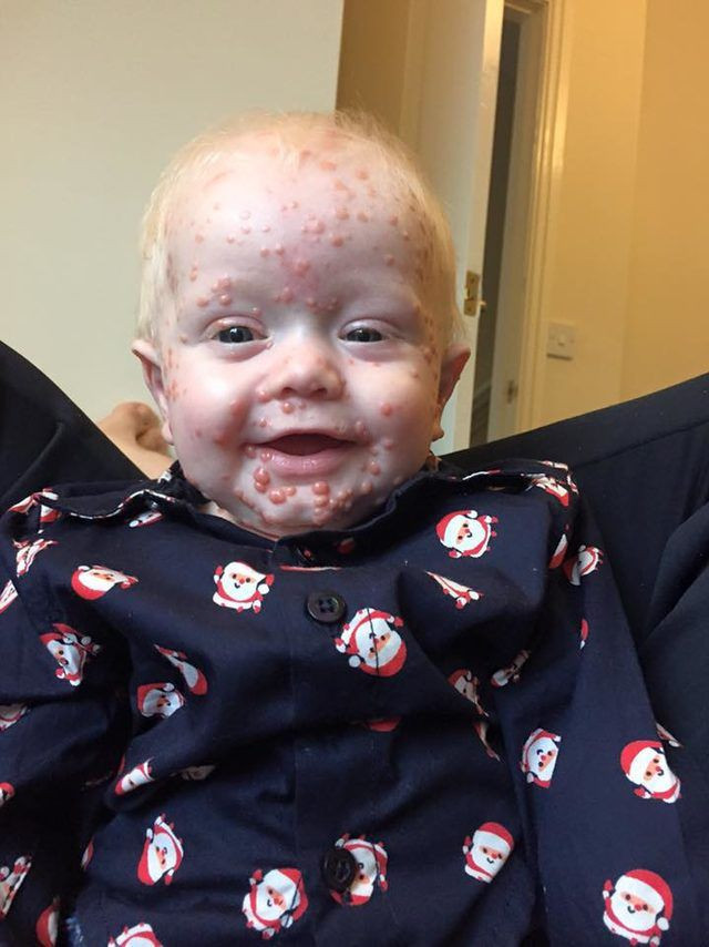 Su çiçeği çıkarıyor sandılar doktora gidince gerçek ortaya çıktı - Resim: 1