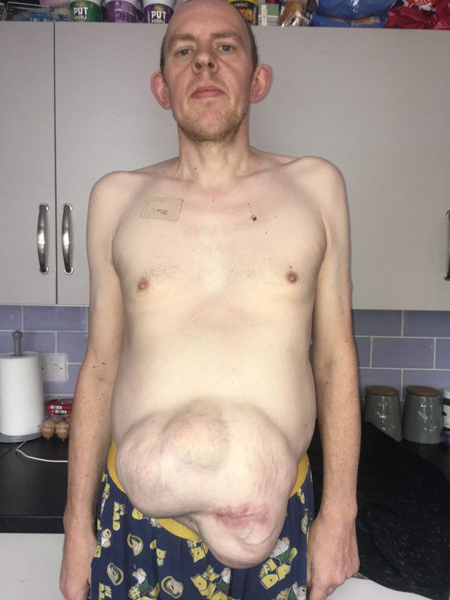 5 yılda bu hale geldi! Hamile gibi görünüyor - Resim: 1