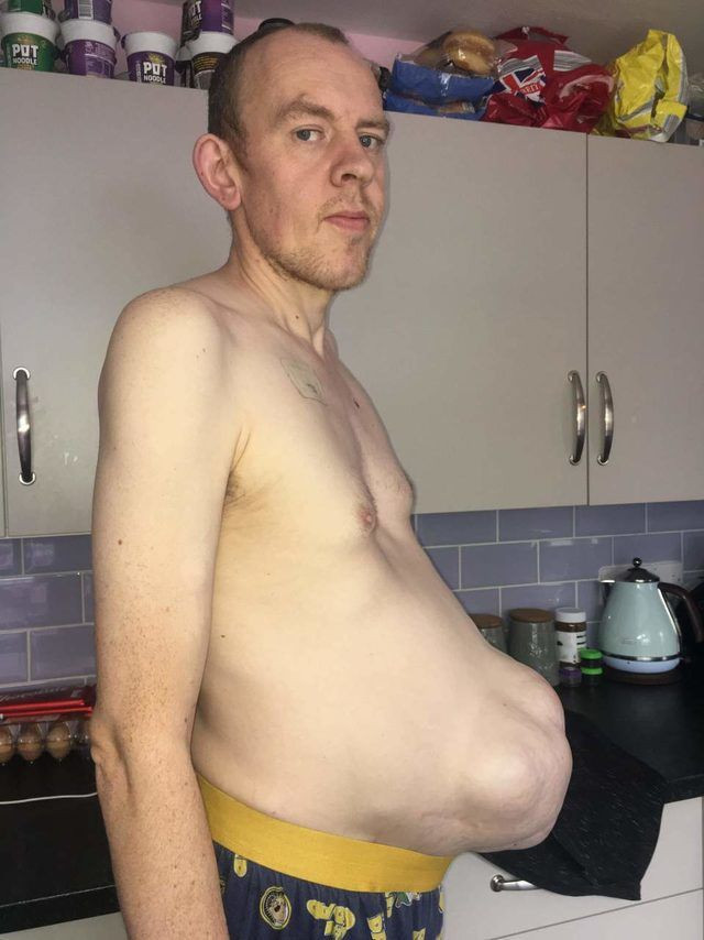 5 yılda bu hale geldi! Hamile gibi görünüyor - Resim: 2