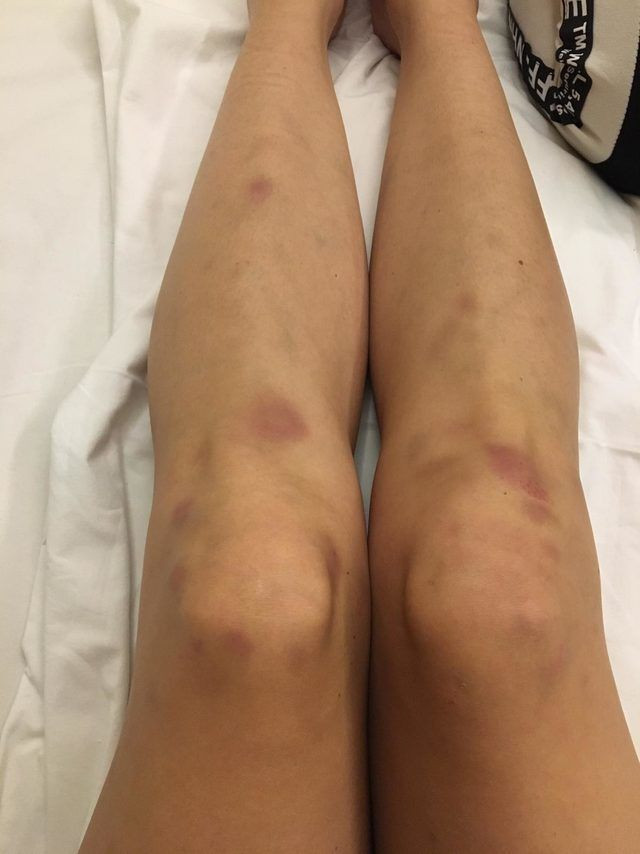 Ortaköy'de sevgilisinin dövdüğü Sırp modelden inanılmaz ifadeler - Resim: 3