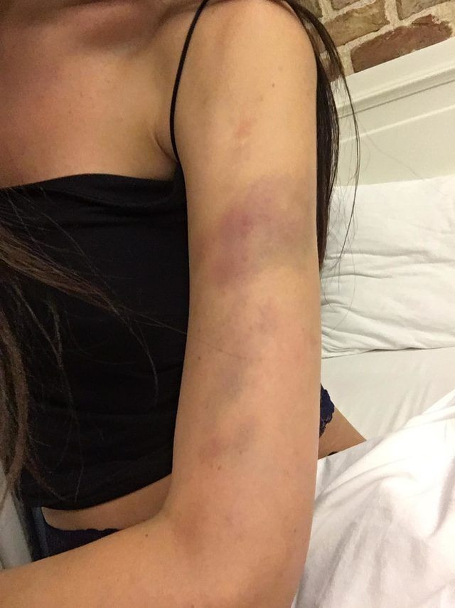 Ortaköy'de sevgilisinin dövdüğü Sırp modelden inanılmaz ifadeler - Resim: 4