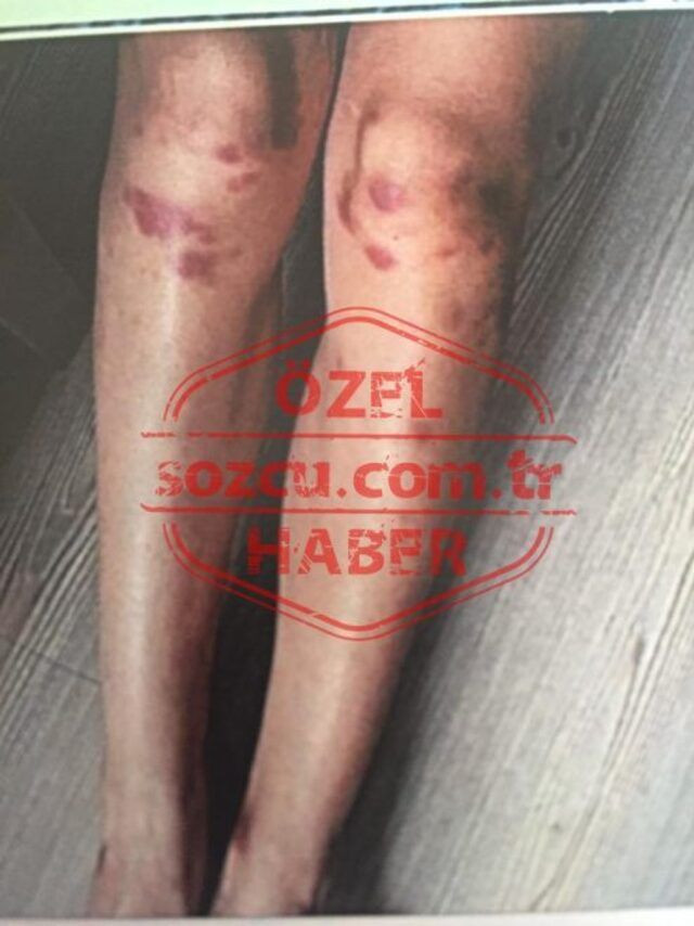 Ozan Güven'in dövdüğü Deniz Bulutsuz'un o geceye dair yeni fotoğrafları ortaya çıktı - Resim: 3