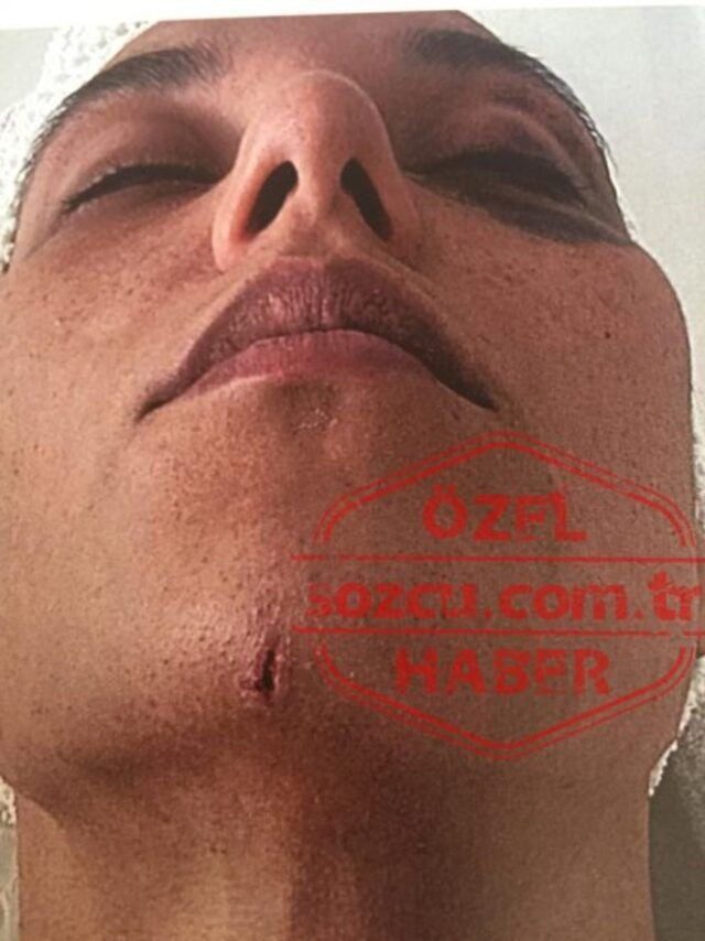 Ozan Güven'in dövdüğü Deniz Bulutsuz'un o geceye dair yeni fotoğrafları ortaya çıktı - Resim: 4