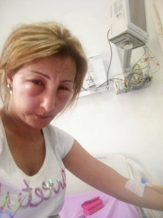 Yalova'da saçlarını yaptırmak için kuaföre gitti, az kalsın canından oluyordu - Resim: 3