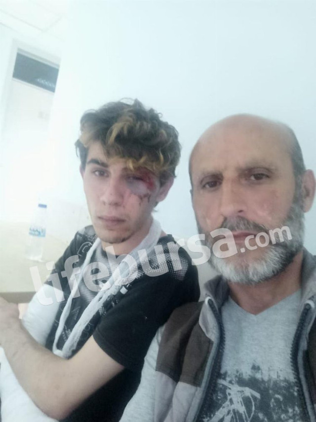 Sevgilisinden çıplak fotoğraf isteyip kendisine silahla işkence ettiler! Sosyal medyada yayınladılar - Resim: 1