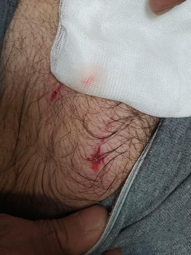 Bingöl'de köpeklerin saldırısına uğrayan baba- oğul yaralandı - Resim: 0