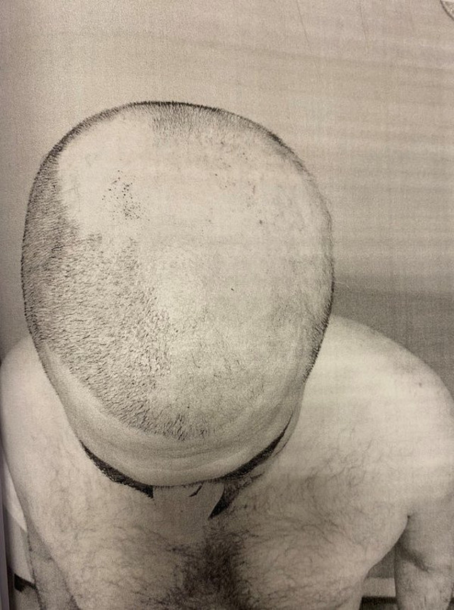 Öğrenci yurdunda akıl almaz işkence! Bağlayıp sakallarını ve saçlarını sıcak ağda ile kökünden söktüler - Resim: 4