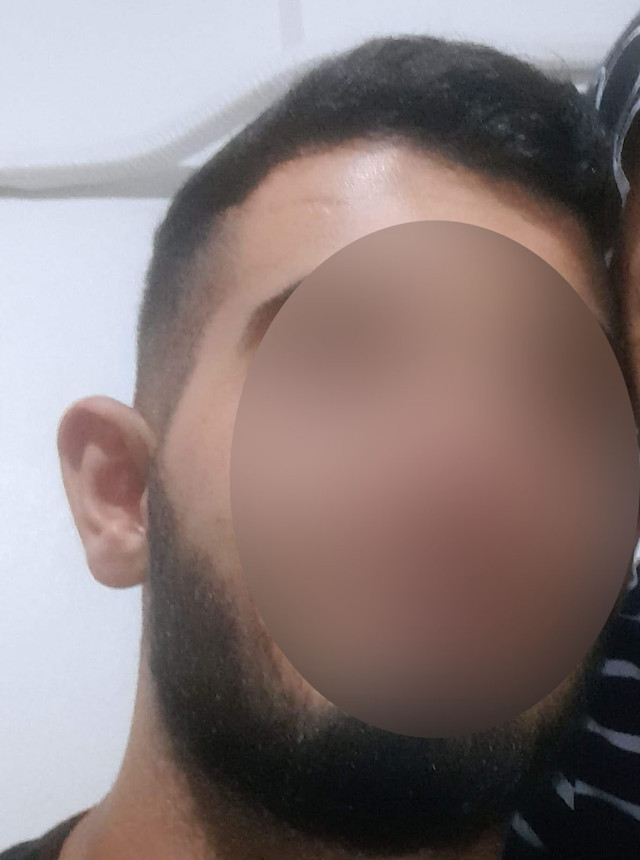 Adana’da üvey evlat vahşeti! 'Başkasıyla evlenemesin' diye yüzüne kezzap attı - Resim: 1