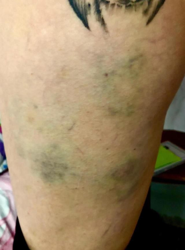 Sermiyan Midyat savaş alanına çevirmiş! Sevcan Yaşar'a darp görüntüleri - Resim: 3