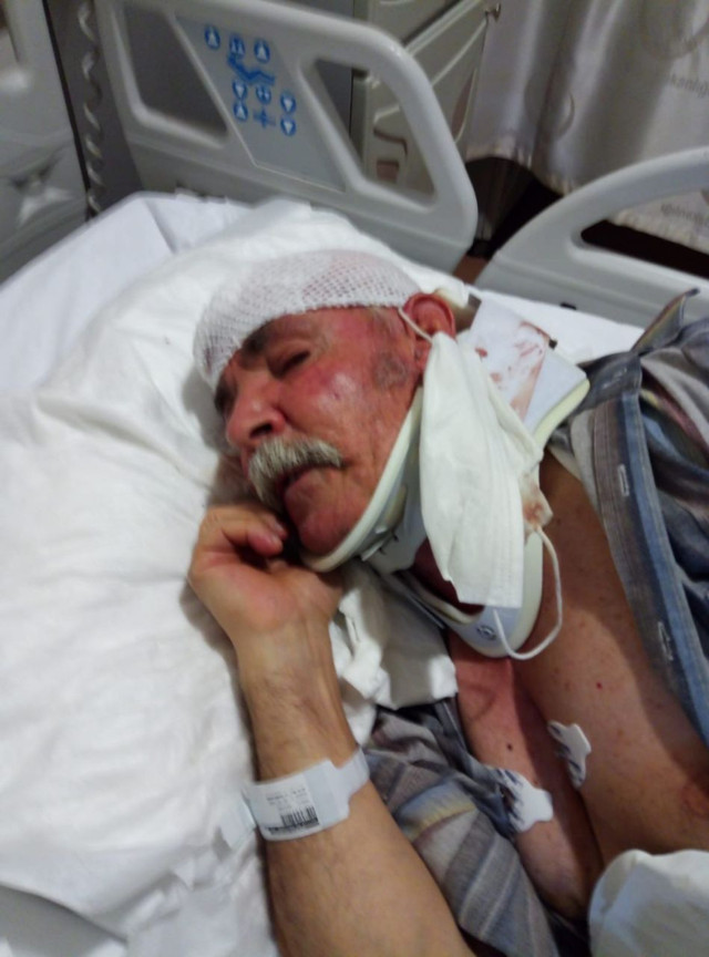 Sakarya'da gittiği pazarda öldüresiye yumruklu saldırıya uğradı - Resim: 0