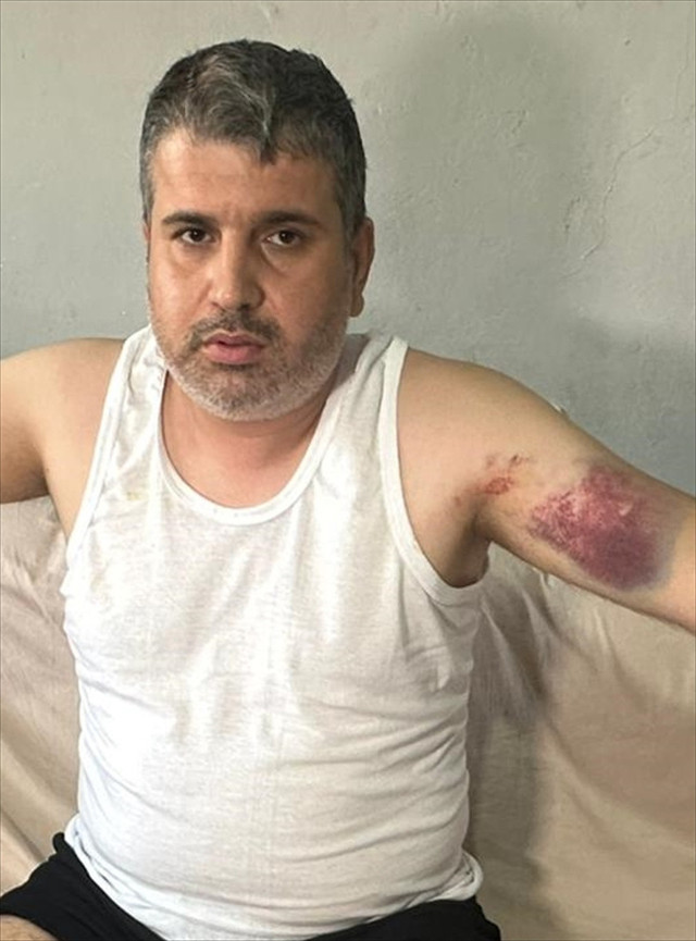 Yeğenini beyzbol sopasıyla bu hale getirdi! Acımasız dayı tutuklandı - Resim: 1