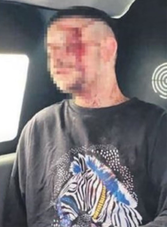 İstanbul'da dehşet! Ormana götürüp sadece kafaları dışarda kalacak şekilde gömdüler - Resim: 1