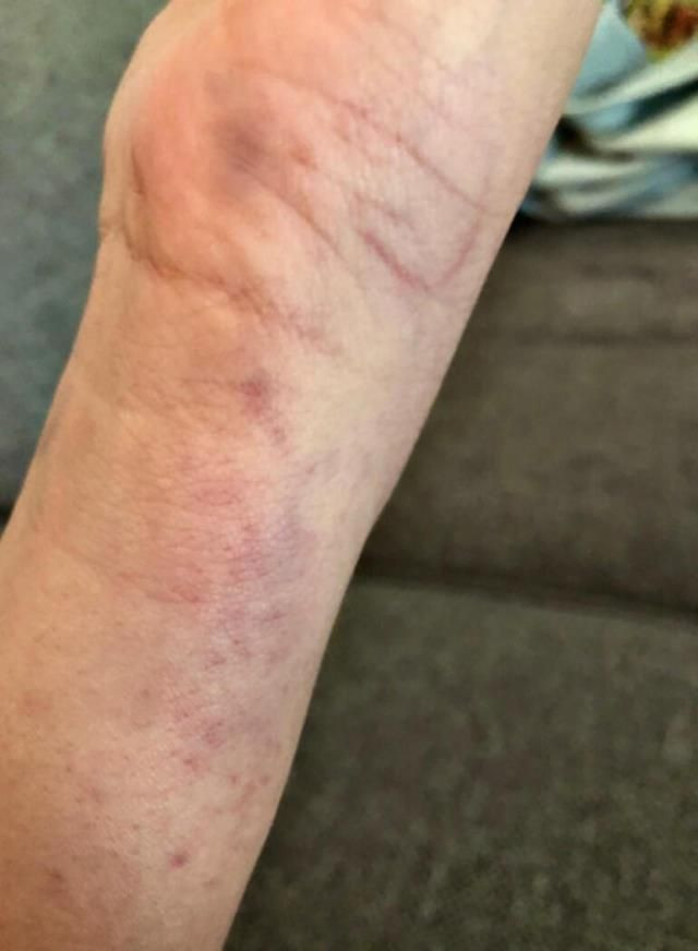 Sermiyan Midyat savaş alanına çevirmiş! Sevcan Yaşar'a darp görüntüleri - Resim: 4