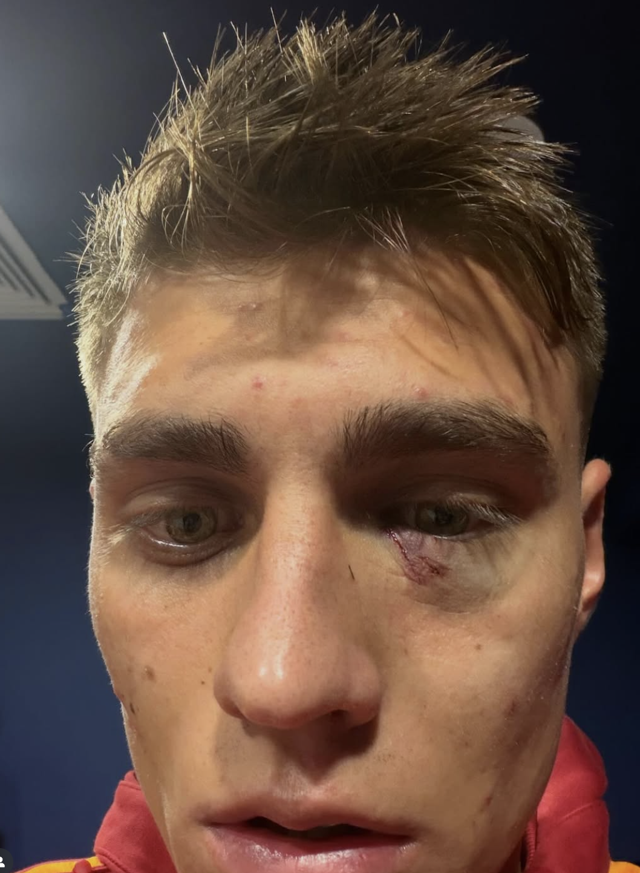 Derbide Kazımcan'ın yüzüne çakmak atan taraftar yakalandı - Resim: 0