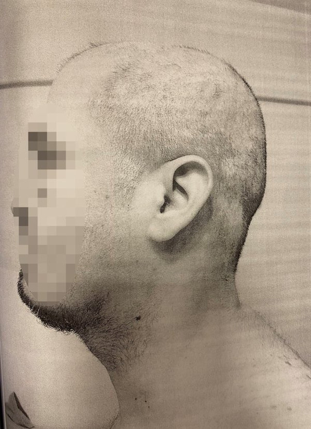 Öğrenci yurdunda akıl almaz işkence! Bağlayıp sakallarını ve saçlarını sıcak ağda ile kökünden söktüler - Resim: 2