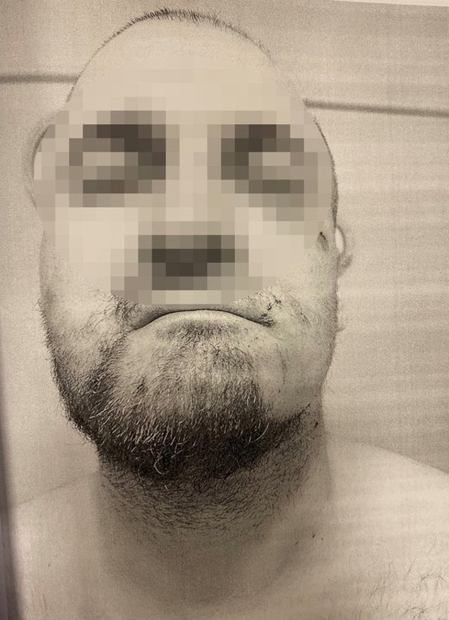 Öğrenci yurdunda akıl almaz işkence! Bağlayıp sakallarını ve saçlarını sıcak ağda ile kökünden söktüler - Resim: 0