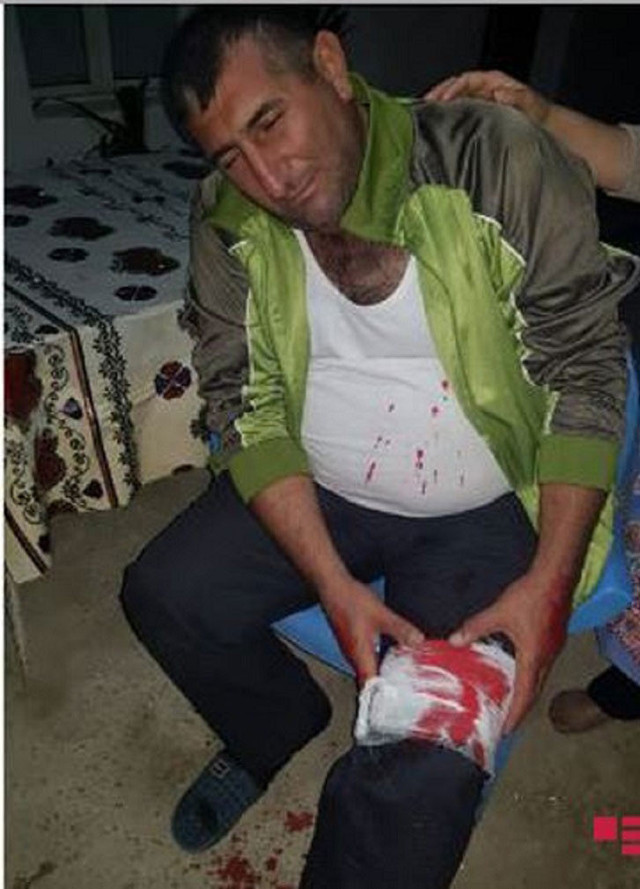 Ermenistan sivilleri vurdu! Azerbaycan'dan sert karşılık geldi gerilim tırmanıyor - Resim: 1