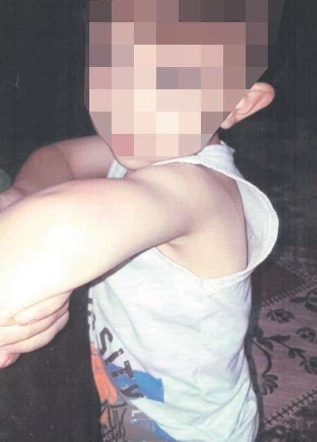 Canavar anne! 4 yaşındaki öz çocuğunun vücudunda sigara söndürmüş - Resim: 0