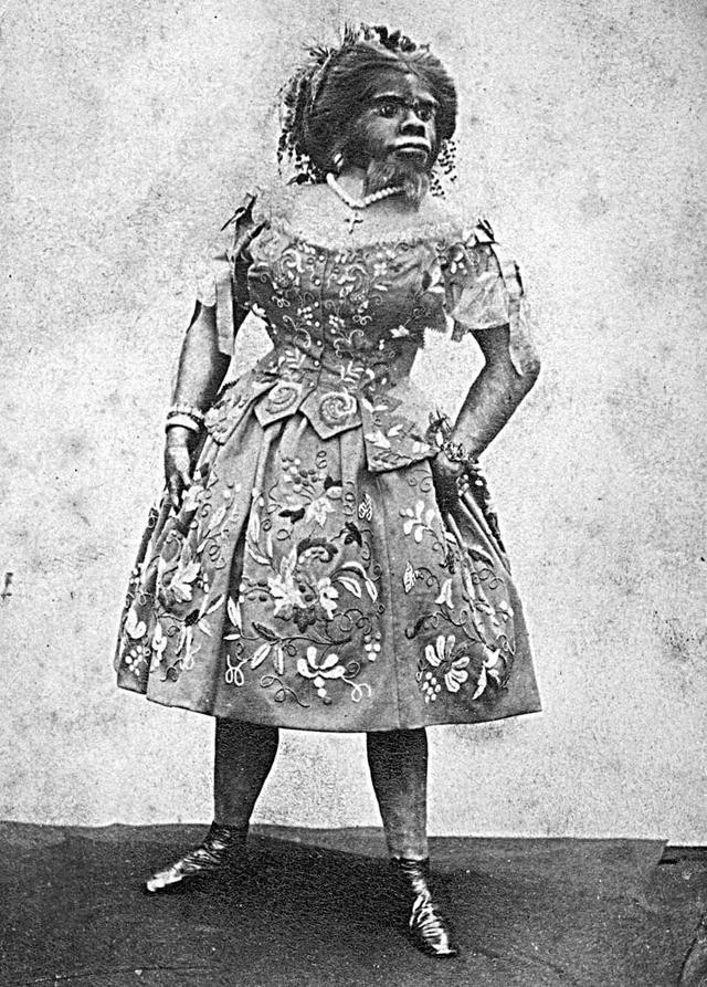 Dünyayı şaşkına çeviren 'maymun kadın' inanılmaz - Resim: 1