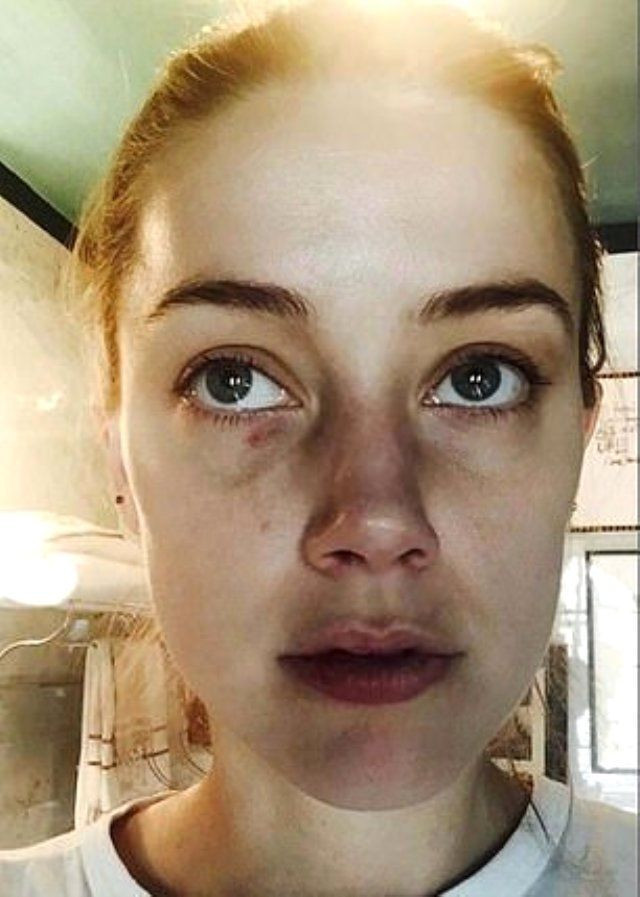 Johnny Depp eski eşi Amber Heard'dan şiddet gördüğünü açıkladı! - Resim: 2